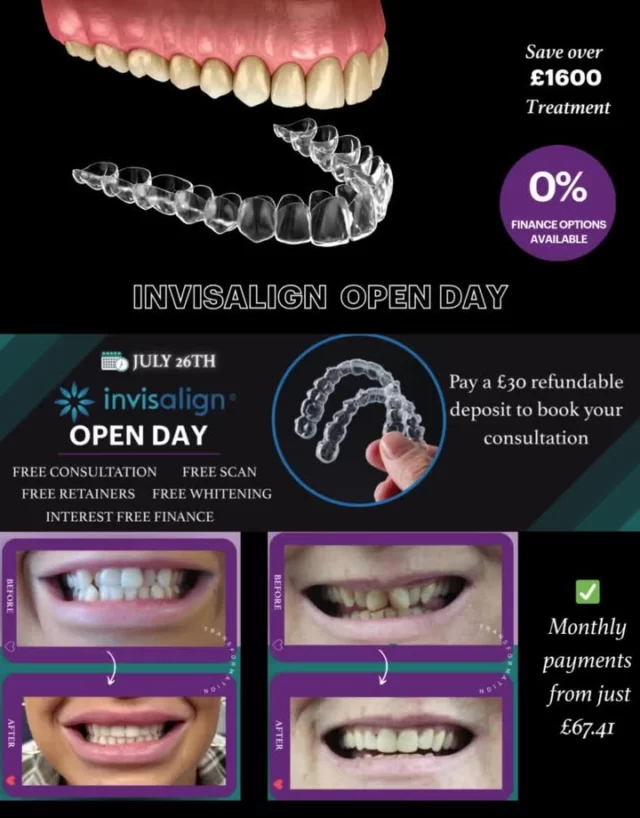🎉 Invisalign Open Day – You're Invited! 🎉
Looking to straighten your smile without metal braces? Now’s the perfect time!

Join us at Avenue Dental Centre on Saturday, 26th July 2025 for our exclusive Invisalign Open Day 🦷✨

✅ Free Consultation
✅ Free 3D Smile Scan
✅ Free Whitening Kit & Retainers
✅ 0% Interest-Free Finance
💰 Special Offer: £2899 (normally £3595!)

👀 Plus, see your new smile before you even start with our iTero simulation scan!

📍 Limited slots available – book now to avoid missing out!
📞 0161 515 8113
 Book Online - https://audental.co.uk/avenue-dental-centre

#StraightTeeth #ClearBraces #SmileTransformation #InvisalignUK #Invisalign #FreeConsultation #InvisalignOffer #Leigh