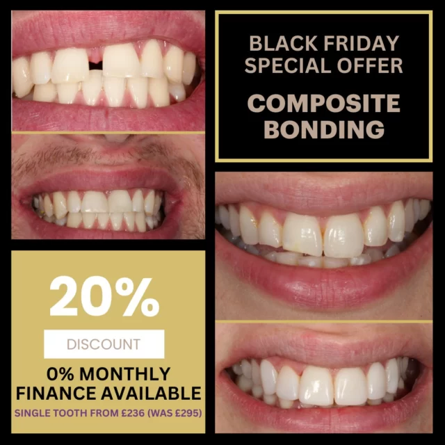 Get 20% OFF Composite Bonding — our best offer ever for a flawless, confident smile! 😁
Limited time only ⏳
📅 Offers valid until 30th November
Don’t miss out — book your appointment today!
https://audental.co.uk/avenue-dental-centre or call us 01942 676336

#BlackFriday #DentalOffers #SmileMakeover #Invisalign #CompositeBonding #TeethWhitening