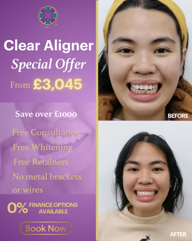Transform your smile with our 32Co Clear Aligner Offer Month – aligners starting from £3,045, including free consultation, whitening, and retainers.

📅 Offer valid 1–31 March 2026
💜 Secure your spot today with a £30 deposit and book your FREE consultation!
Start your smile transformation today.

🔗 Book online: https://audental.co.uk/avenue-dental-centre/
📞 Call us: 01942 676 336

#32Co #ClearAligners #SmileTransformation #AvenueDentalCentre #Leigh