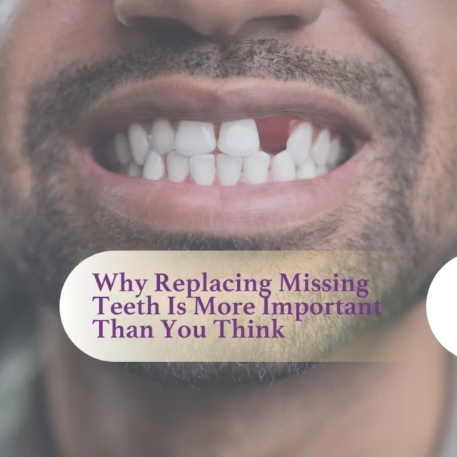 🦷 Why Replacing Missing Teeth Is More Important Than You Think

🌐 Visit our website to read our latest blog!
Link in Bio.
#MissingTeeth #DentalHealth #OralCare #SmileRestoration #DentalImplant