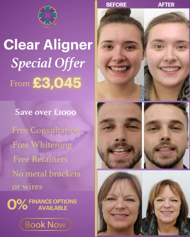 ⏳ Last chance! Offer ends 31st March

Clear aligners are a discreet and effective way to straighten your teeth—and the results speak for themselves ✨
Check out these amazing before & after transformations!

💜 Book your FREE consultation today
💳 Secure your spot with just a £30 deposit
🔗 Book online: https://audental.co.uk/avenue-dental-centre/
📞 Call us: 01942 676 336

#ClearAligners #SmileMakeover #32Co #AvenueDentalCentre #Leigh