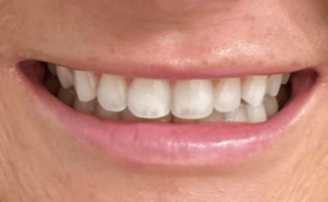 Before - bredbury-dental-centre