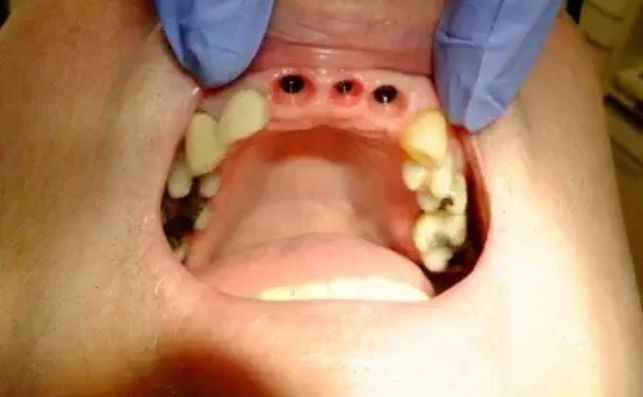 Before - bredbury-dental-centre