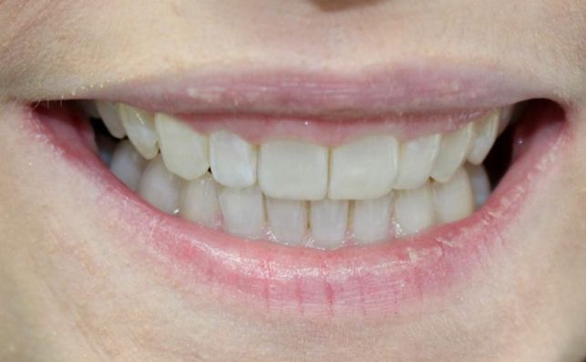 After - bredbury-dental-centre
