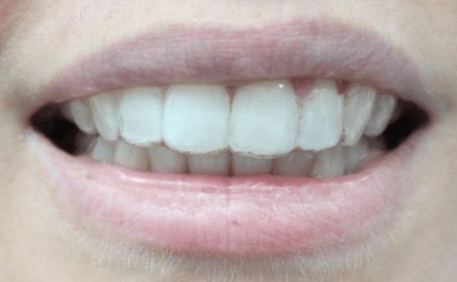 After - bredbury-dental-centre