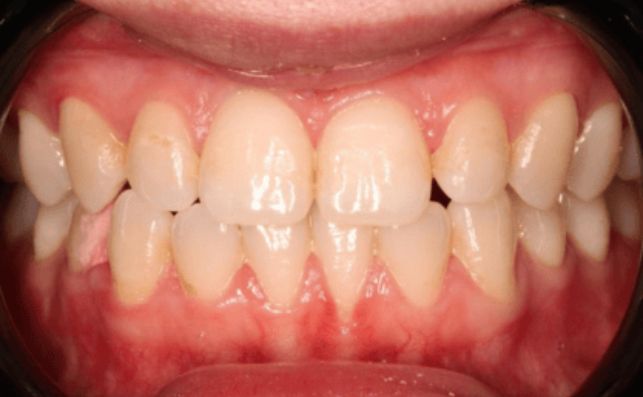 Before - bredbury-dental-centre