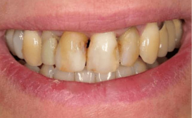 Before - bredbury-dental-centre