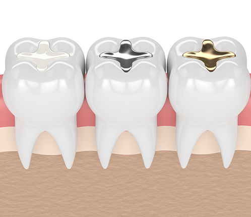 Treatment - Park Lane Dental Centre