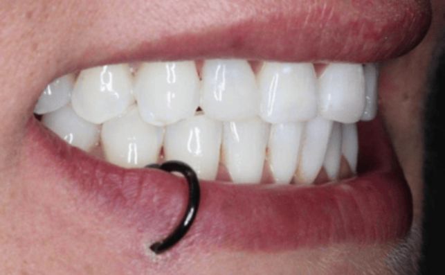 After - prestbury-road-dental