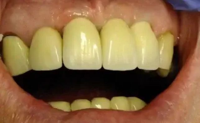 After - prestbury-road-dental