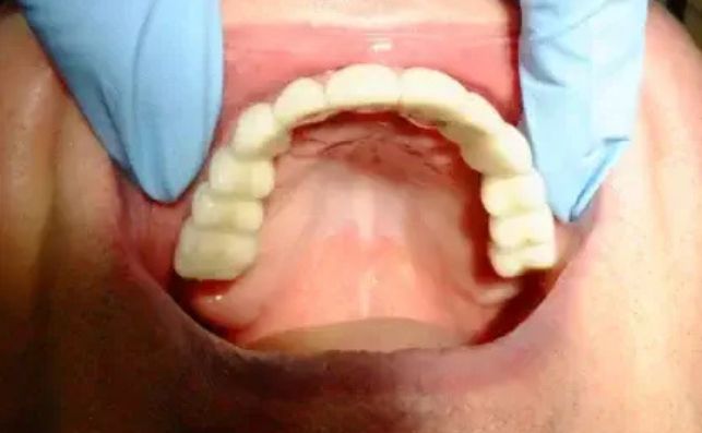 After - prestbury-road-dental