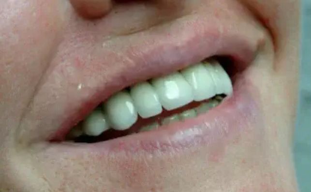 After - prestbury-road-dental