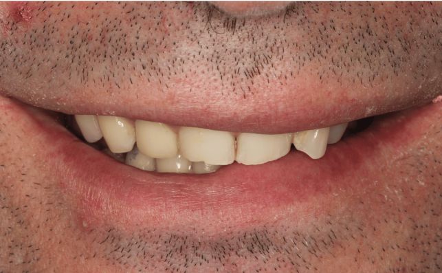 Before - prestbury-road-dental