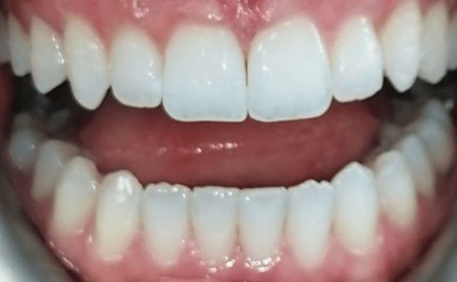 After - prestbury-road-dental
