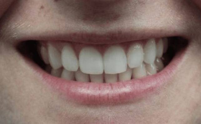 After - prestbury-road-dental