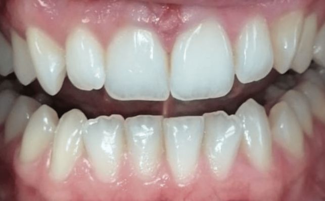 Before - prestbury-road-dental