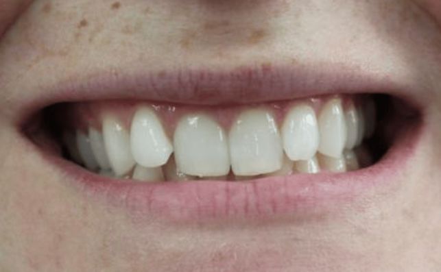 Before - prestbury-road-dental