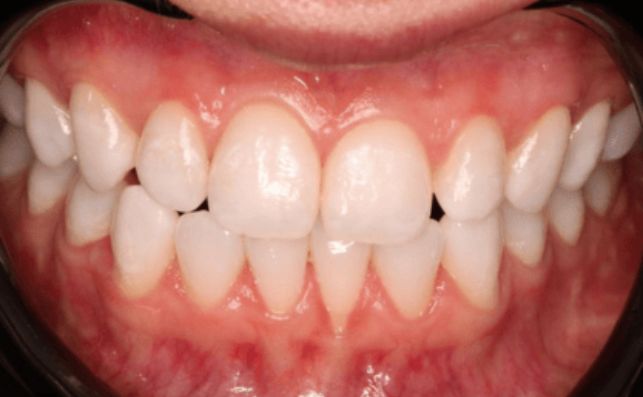 After - prestbury-road-dental