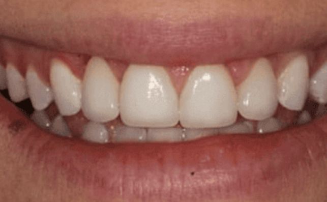 After - prestbury-road-dental