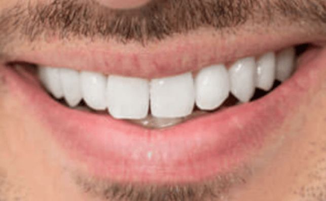 After - prestbury-road-dental