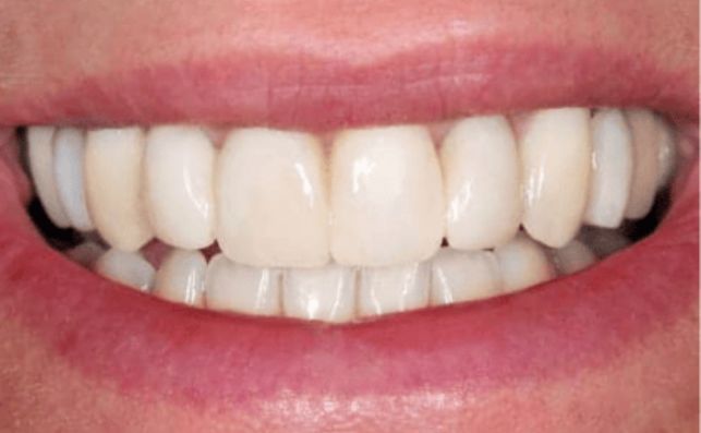 After - prestbury-road-dental