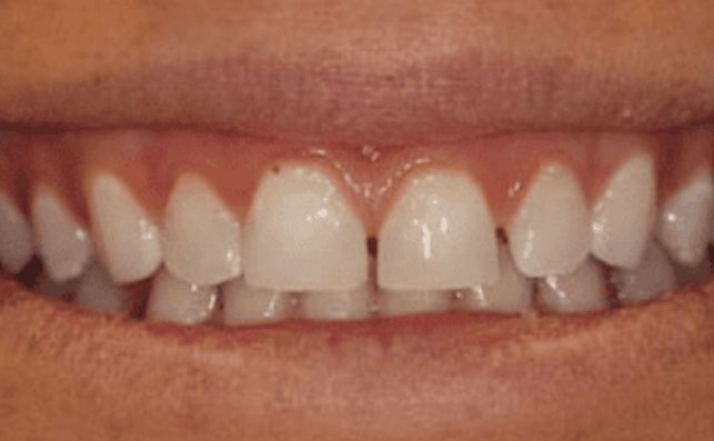 Before - prestbury-road-dental